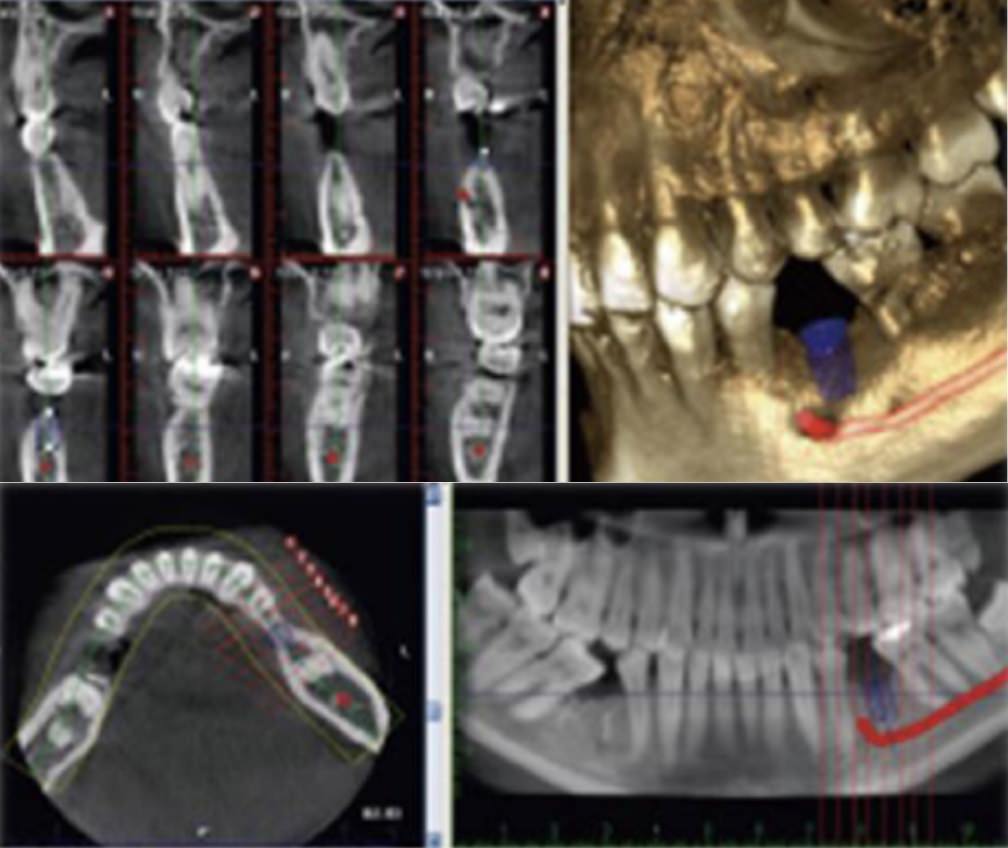歯科用CT装置2