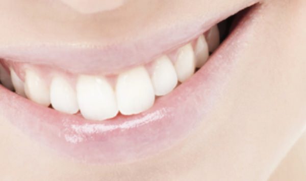 白い歯の笑顔に憧れませんか？