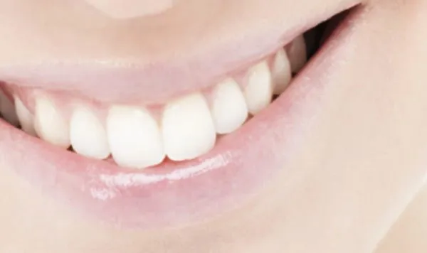 白い歯の笑顔に憧れませんか?